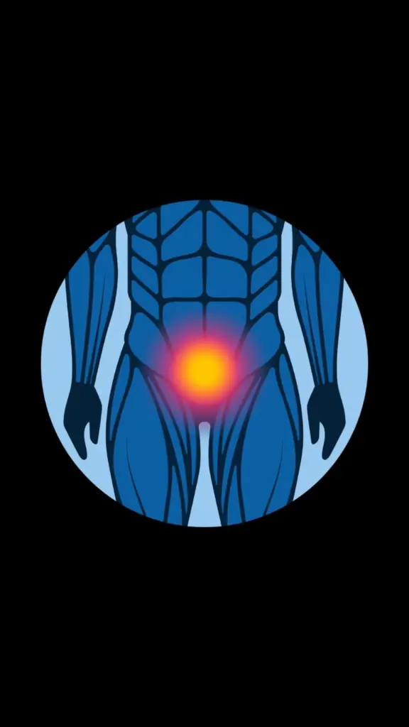 Pós Operatorio de Cancer de Prostata